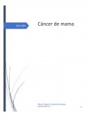 El cáncer de mama. Semiología