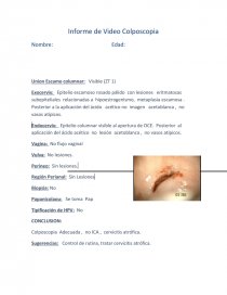 Ejemplos Informe Colposcopia. - Informes - 19761407