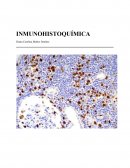 Que es la Inmunohistoquímica