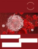 RADIACIÓN ULTRAVIOLETA Y LEUCEMIA AGUDA