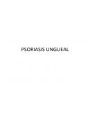 Psoriasis Ungueal